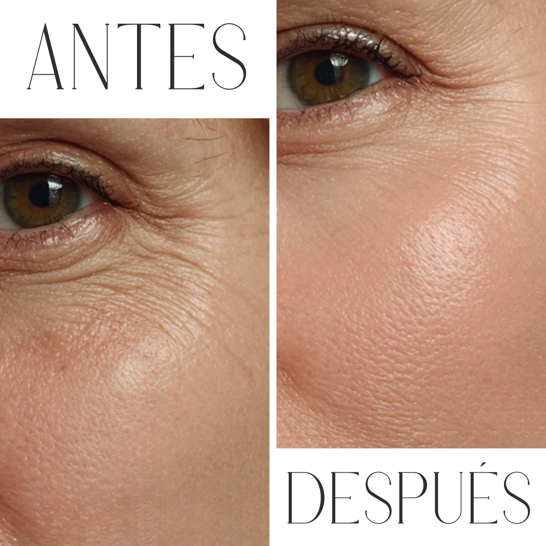 Ampolla De Péptidos Reafirmantes Halentia®