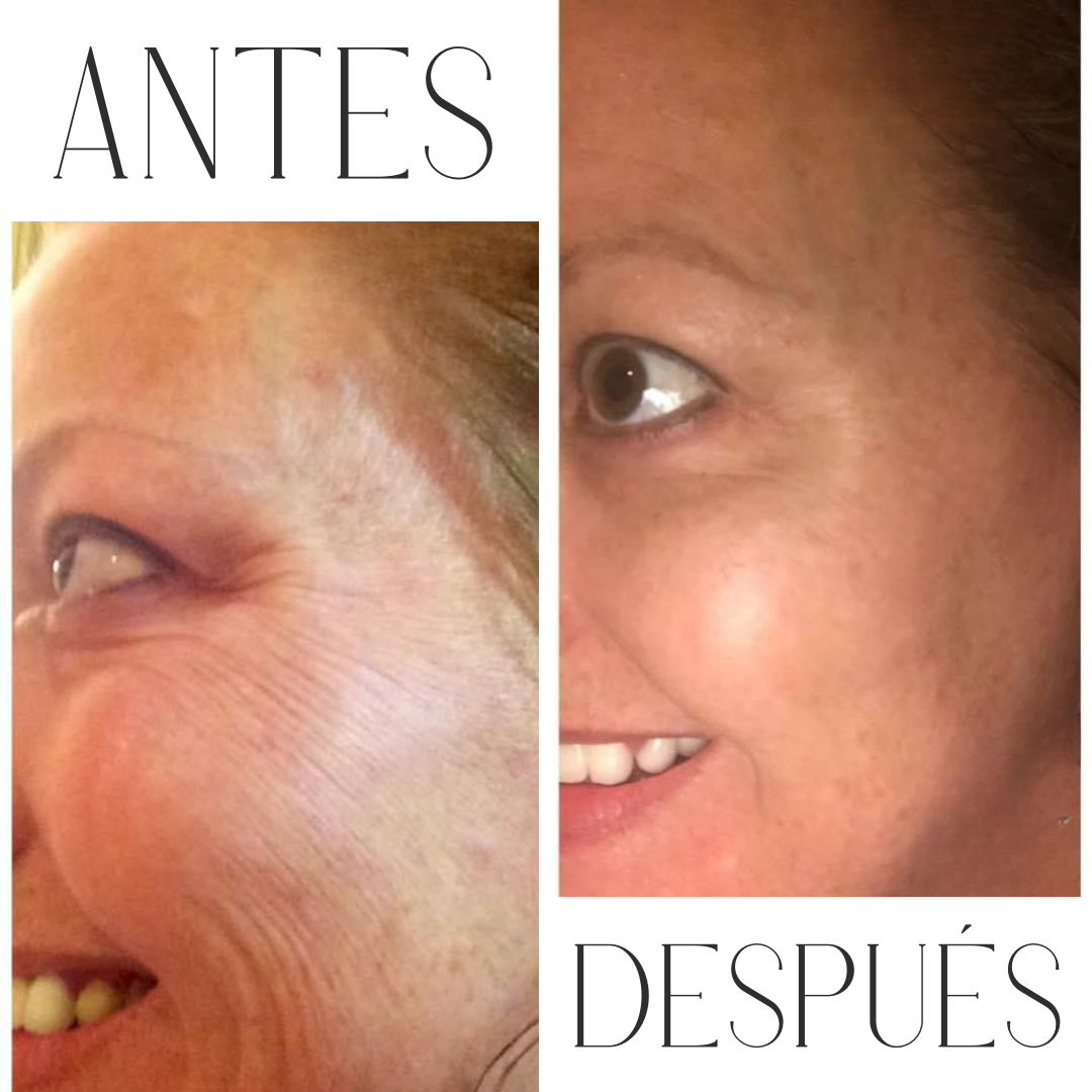 Ampolla De Péptidos Reafirmantes Halentia®